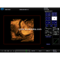 DW-C900 4D Farb-Doppler-Ultraschallgerät mit Elastographie-Funktion